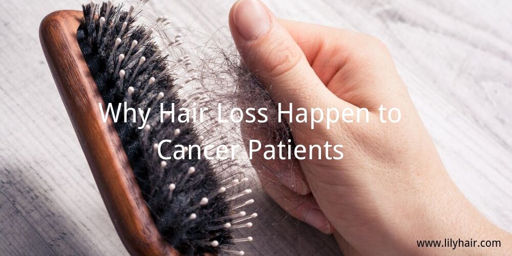 Why Hair Loss Happen to Cancer Patients?